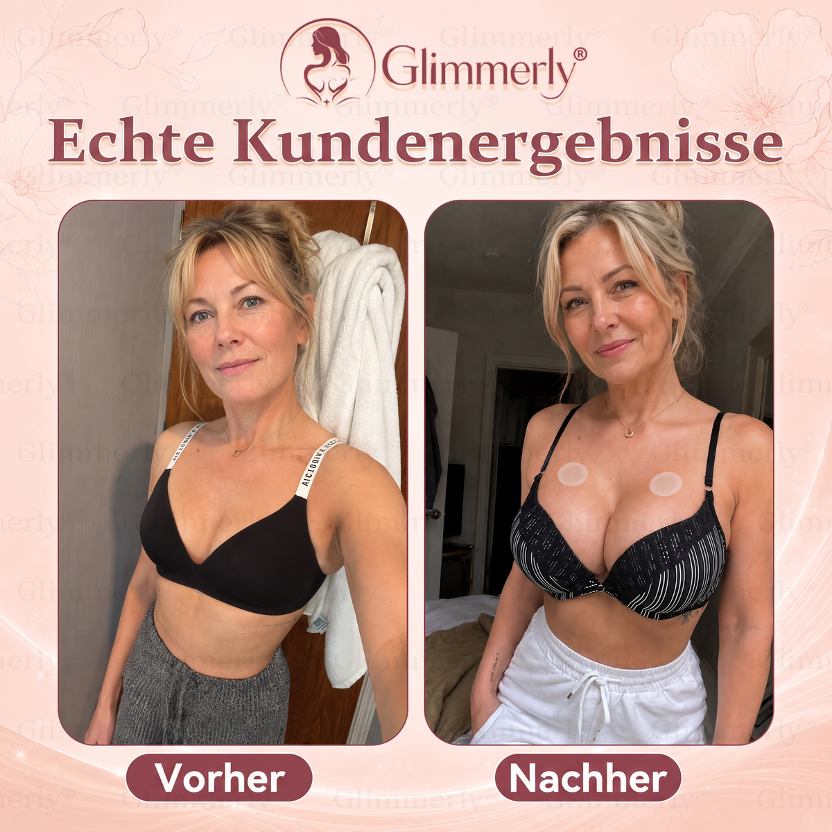 𝐆𝐥𝐢𝐦𝐦𝐞𝐫𝐥𝐲® Mikro-Nadel-Pflaster für mehr Brustvolumen & ein strafferes Erscheinungsbild