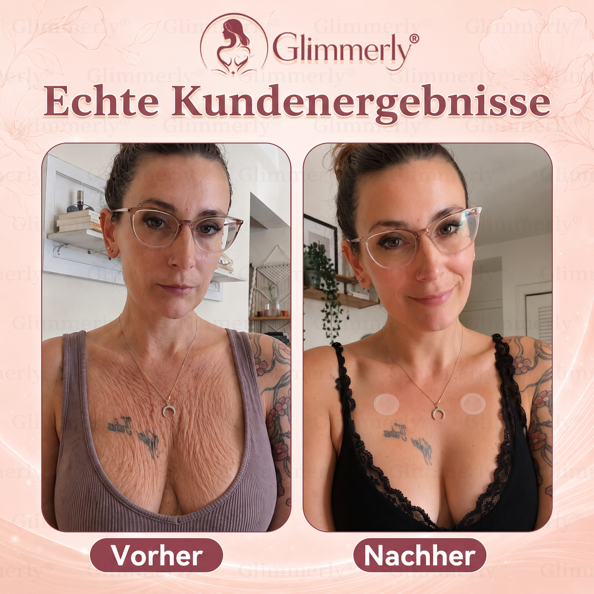 𝐆𝐥𝐢𝐦𝐦𝐞𝐫𝐥𝐲® Mikro-Nadel-Pflaster für mehr Brustvolumen & ein strafferes Erscheinungsbild
