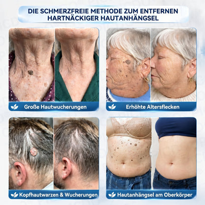𝐏𝐢𝐜𝐝𝐨® 🍃 𝐂𝐑𝐄𝐌𝐄 𝐆𝐄𝐆𝐄𝐍 𝐇𝐀𝐔𝐓𝐀𝐍𝐇𝐀𝐍𝐆𝐒𝐄𝐋&𝐏𝐈𝐆𝐌𝐄𝐍𝐓𝐅𝐋𝐄𝐂𝐊𝐄𝐍(Formel ohne Schmerzen und Narben) 🎉