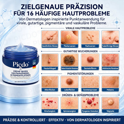 𝐏𝐢𝐜𝐝𝐨® 🍃 𝐂𝐑𝐄𝐌𝐄 𝐆𝐄𝐆𝐄𝐍 𝐇𝐀𝐔𝐓𝐀𝐍𝐇𝐀𝐍𝐆𝐒𝐄𝐋&𝐏𝐈𝐆𝐌𝐄𝐍𝐓𝐅𝐋𝐄𝐂𝐊𝐄𝐍(Formel ohne Schmerzen und Narben) 🎉