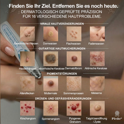 Offizieller Markenstore |✅𝑷𝑖𝒄𝐝𝐨® 7-𝑻𝒂𝒈𝒆 𝑯𝒂𝒖𝒕𝒂𝒏𝒉ä𝒏𝒈𝒔𝒆𝒍- & 𝑭𝒍𝒆𝒄𝒌𝒆𝒏𝒆𝒏𝒕𝒇𝒆𝒓𝒏𝒆𝒓(Schmerzfreier Rollerball – Keine Narbenbildung)🚀